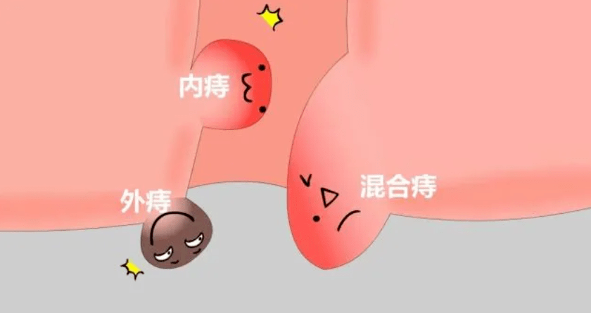̯@ʲô@ôʹ(dng)Ѫ˨